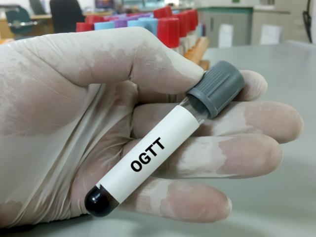 Médico con muestra de tolerancia oral a la glucosa